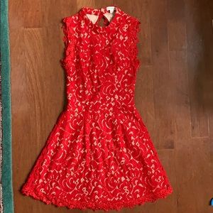 Francesca’s Lace Dress